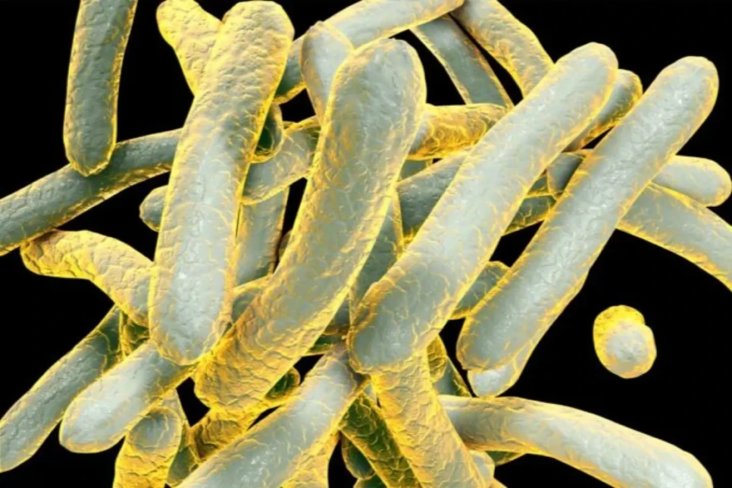 Gizmodo: An Old Foe Dethrones Covid-19 as the World’s Leading Infectious Killer