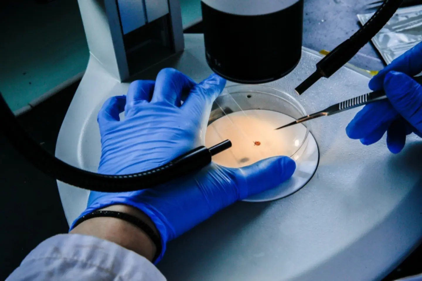 Focar de infecție cu bacteria Legionella
